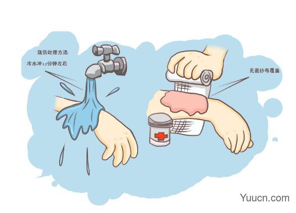烫伤后怎么处理,怎么办 烫伤后怎么处理,怎么办