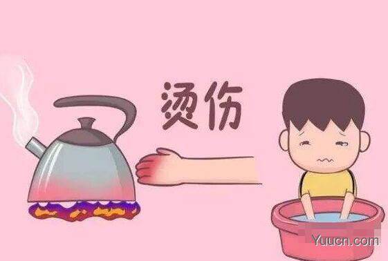 烫伤后怎么处理,怎么办 烫伤后怎么处理,怎么办