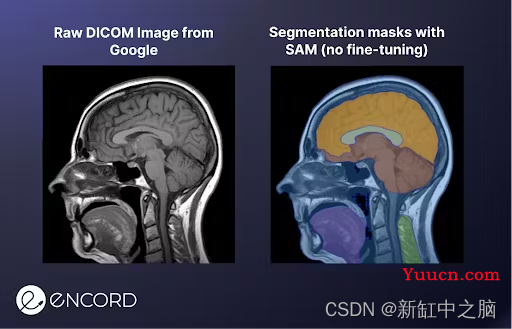 SAM - 分割一切图像【AI大模型】